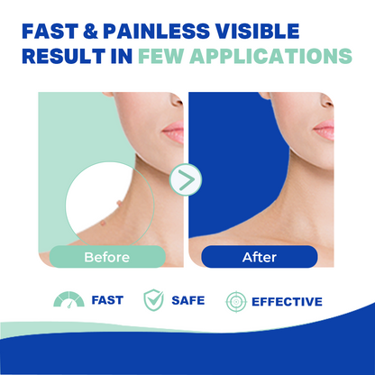 Dr. Yglo Skin Tag Remover