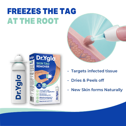 Dr. Yglo Skin Tag Remover