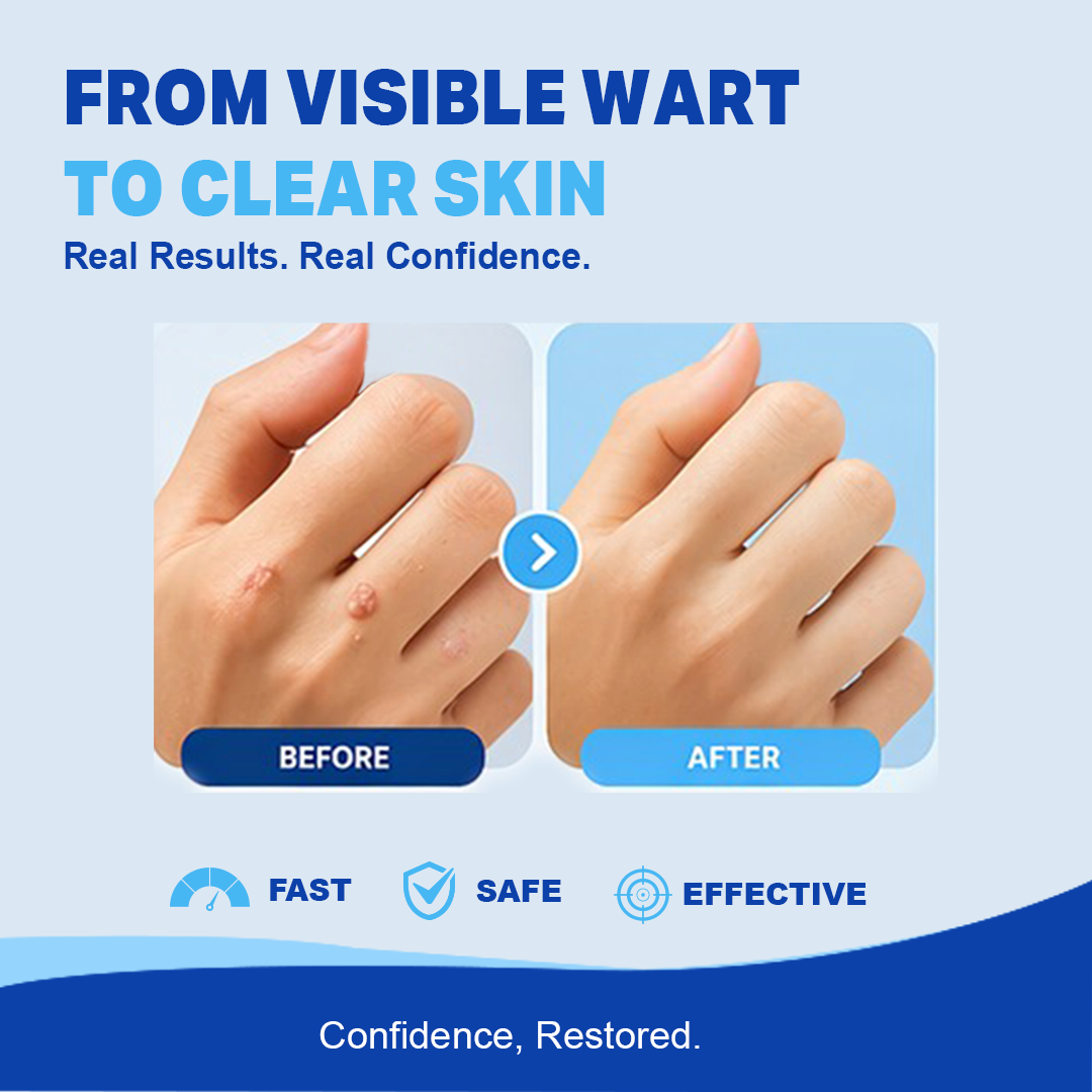 Dr. Yglo Wart Remover