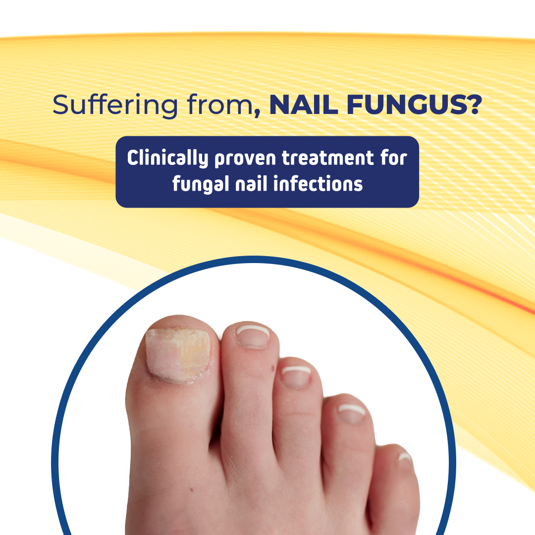 FungeX Nail Fungus Pen