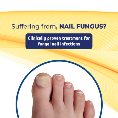 FungeX Nail Fungus Brush