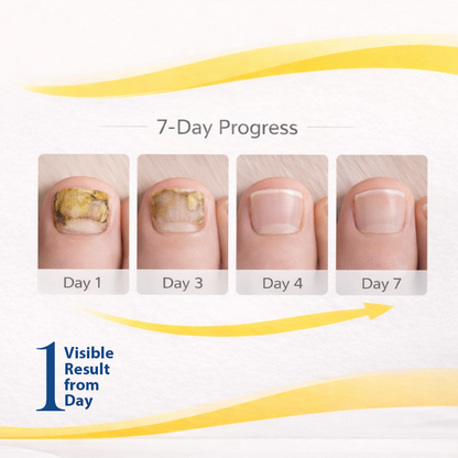 FungeX Nail Fungus Brush